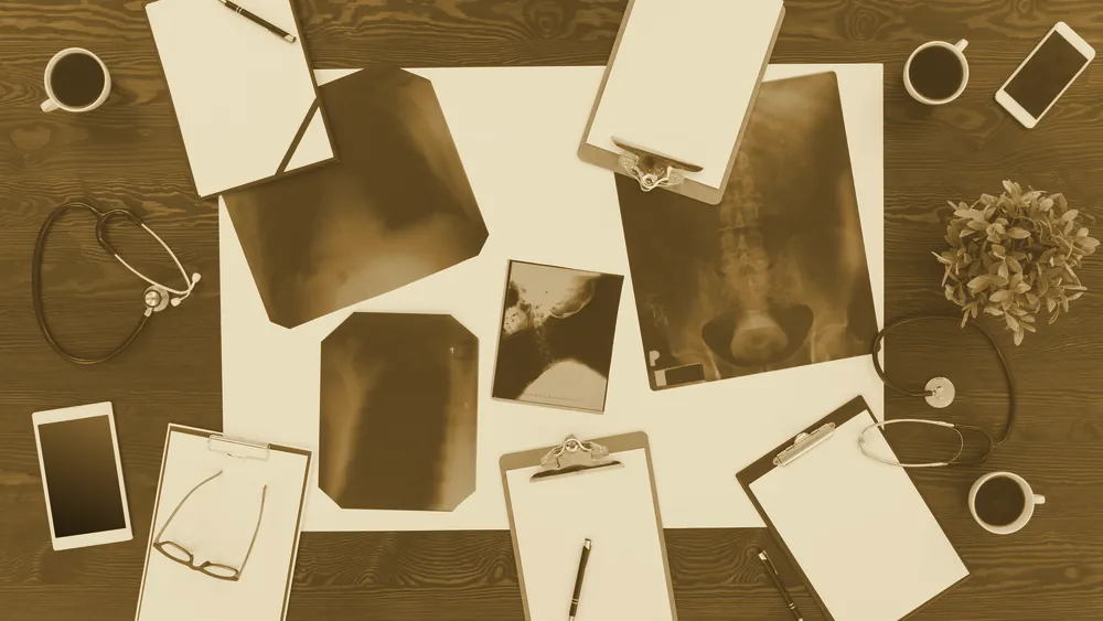 Medical X-rays and diagnostic tools arranged on a table